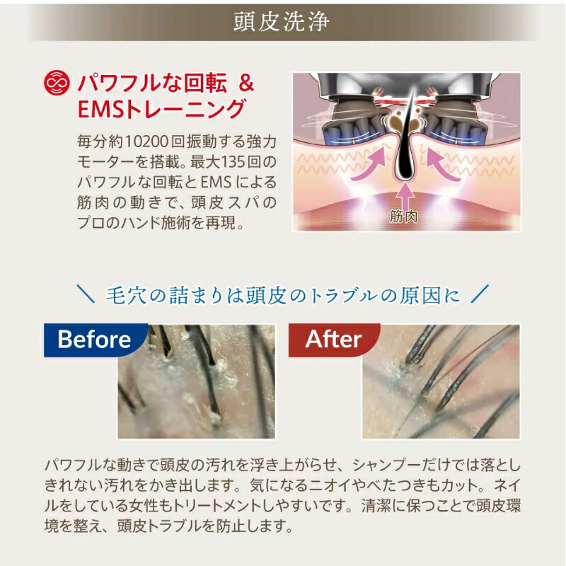 楽天市場】【ポイント10倍】 ゾーガンキンスカルプ EMS ヘッドスパ