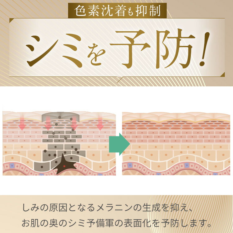 楽天市場】シミ予防 しわ シワ改善 薬用シミシワ ホワイト クリーム お