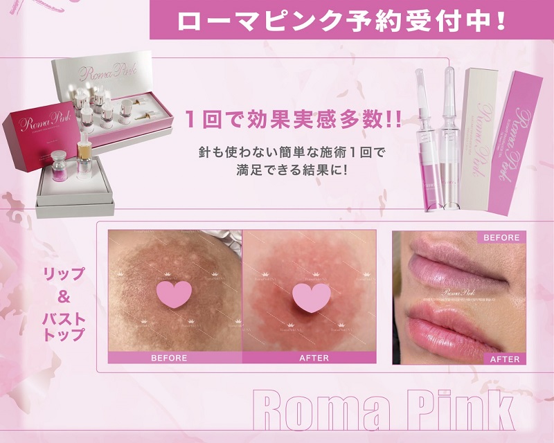 ローマピンク