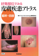 疣贅（いぼ）のみかた，治療のしかた』 ｜ 学研出版サイト