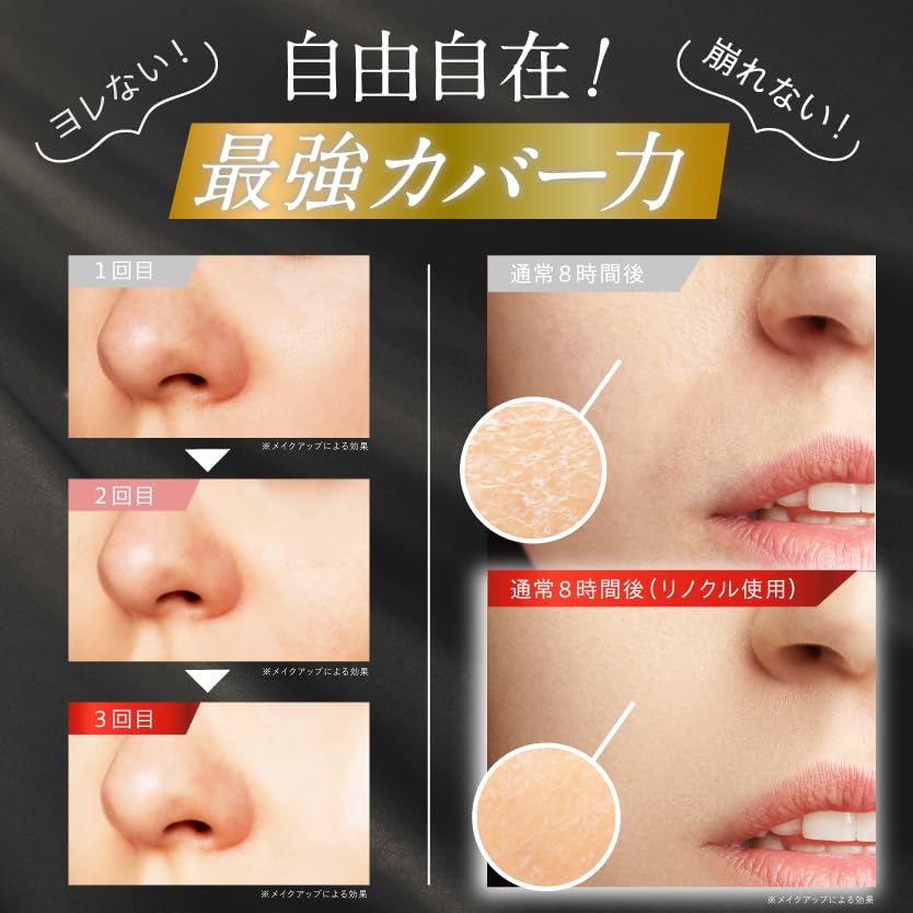 Amazon | 【シミ改善×シワカバー】リノクル ナイアシンアミド リンクル
