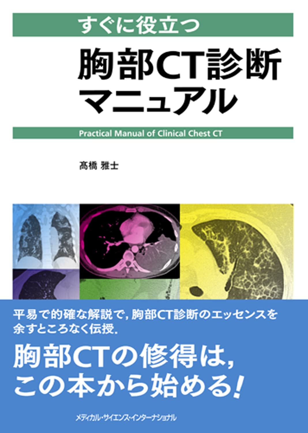 すぐに役立つ胸部CT診断マニュアル | 髙橋雅士 |本 | 通販 | Amazon