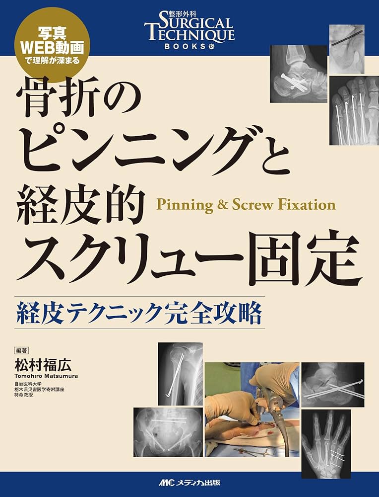 骨折のピンニングと経皮的スクリュー固定： 経皮テクニック完全攻略