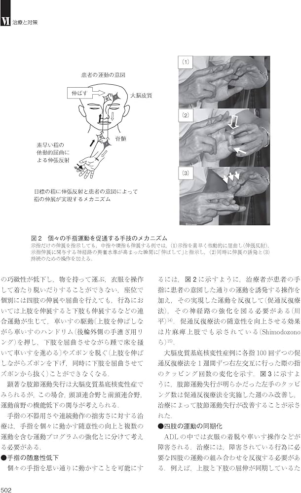 脳血管障害と神経心理学 第2版 | 平山 惠造 |本 | 通販 | Amazon