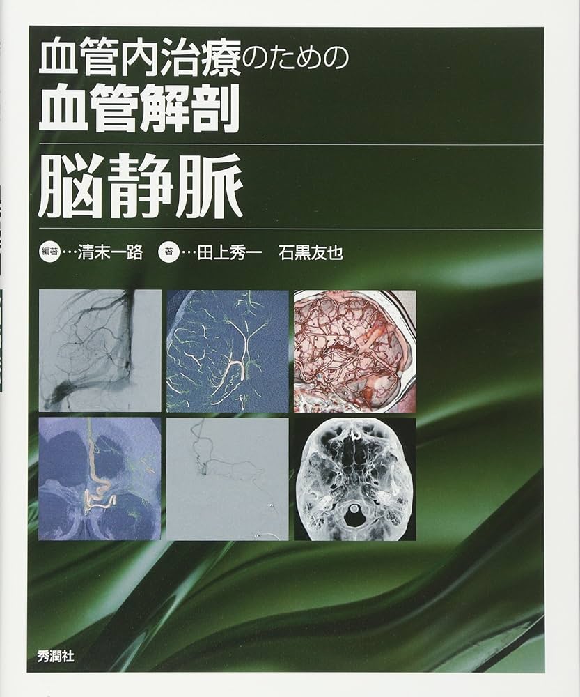 Amazon.co.jp: 血管内治療のための血管解剖 脳静脈 : 清末一路, 田上