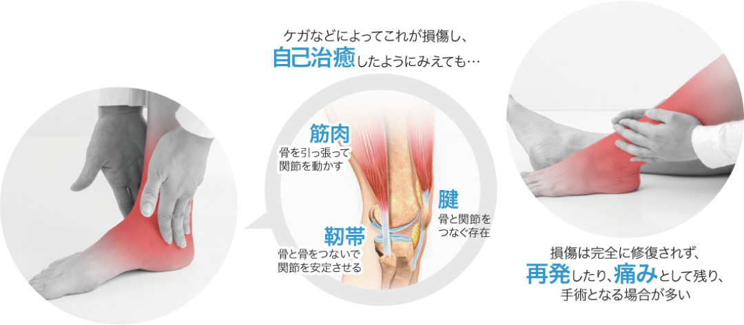 変形性関節症・関節痛 | N2 CLINIC 四谷