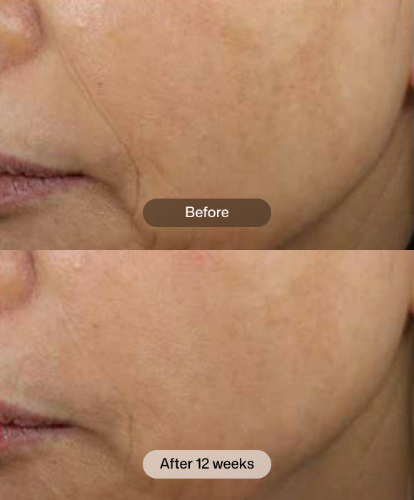 D·E·J Face Cream® | Revision Skincare®
